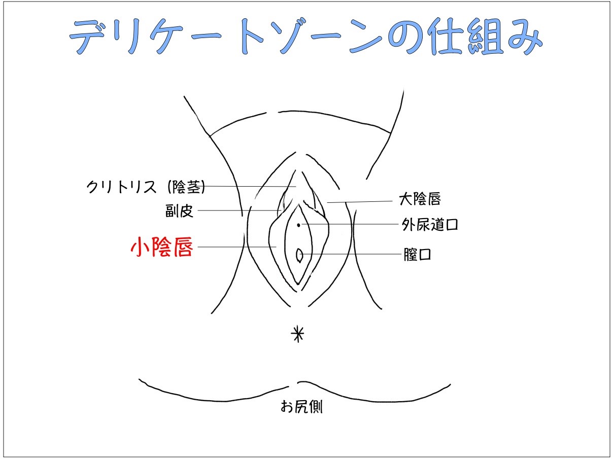 アソコの形に悩んで湘南美容外科クリニックで小陰唇縮小術に挑戦した画像