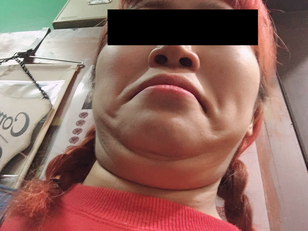 渋木プロテインおやじさんの自撮り画像
